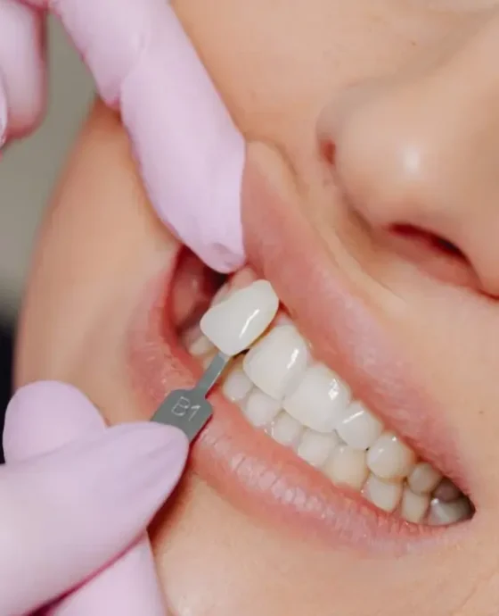 Veneers Are Your Path to a Dazzling Smile